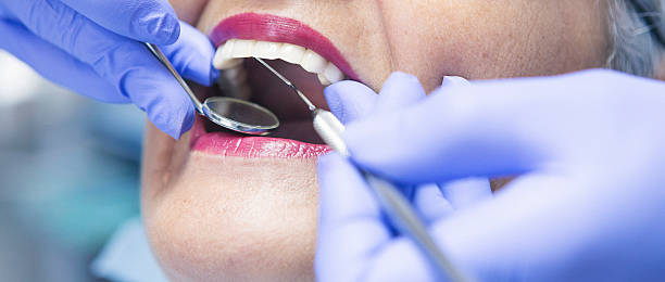 Best Emergency Treatment for Dental Infections or Abscesses in Ellisville, MO